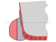 300px-Anti-torpedo_bulge.svg.png